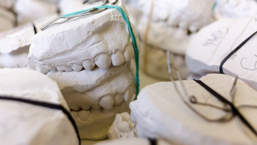 Qué es una corona dental Tipos y precios de fundas dentales