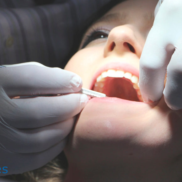 Higiene bucal y tratamientos estéticos: El blanqueamiento dental
