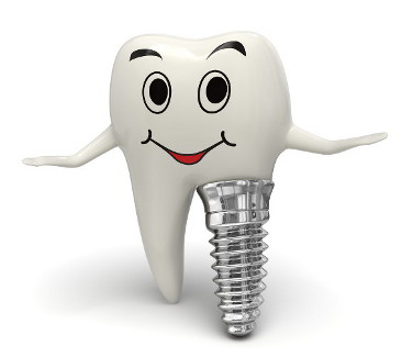 implantes dental