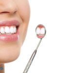 Carillas dentales, ¿Qué son y para qué sirven?
