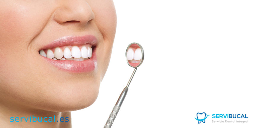 Carillas dentales, ¿Qué son y para qué sirven?