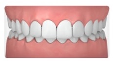 ortodoncia con brackets