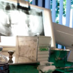 Radiografías dentales: ¿cuándo son necesarias?