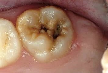 Problemas dentales