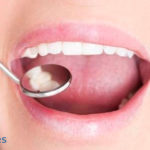 8 Principales problemas dentales más comunes