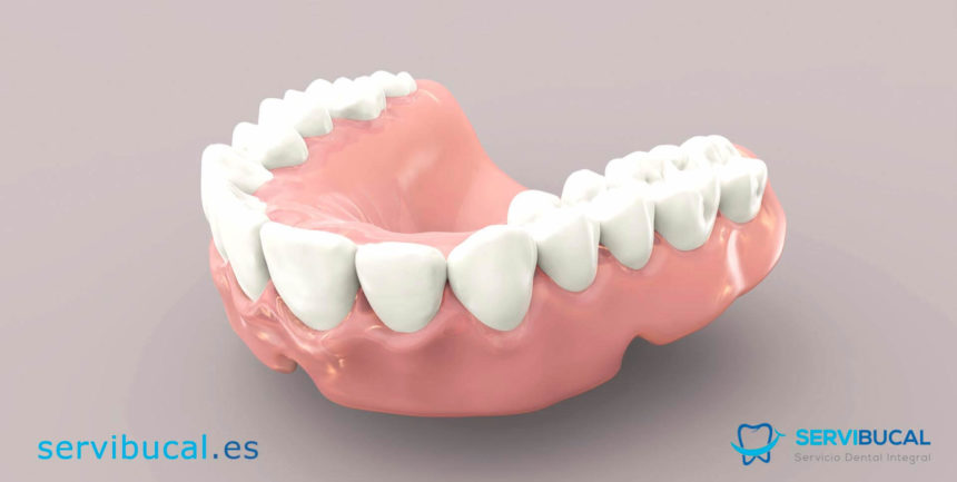 ¿Qué son las prótesis dentales removibles? Tipos y características