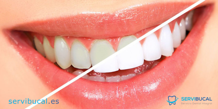 ¿Qué es la odontología estética y cuáles son los tratamientos más novedosos?