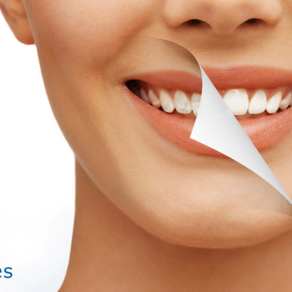 ¿Por qué aparecen manchas en los dientes?, y ¿cómo prevenirlas y eliminarlas?