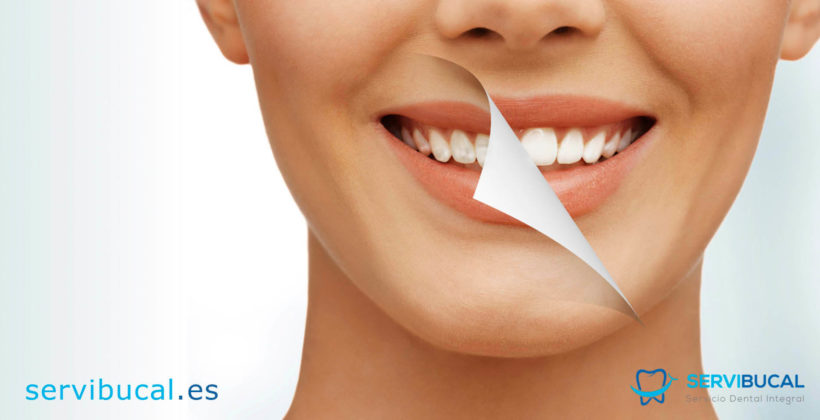 ¿Por qué aparecen manchas en los dientes?, y ¿cómo prevenirlas y eliminarlas?