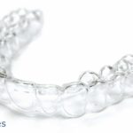 Qué son los retenedores de ortodoncia, para qué sirven y qué tipos hay