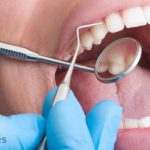 Definición de periodoncia, ¿qué es y en qué consiste?