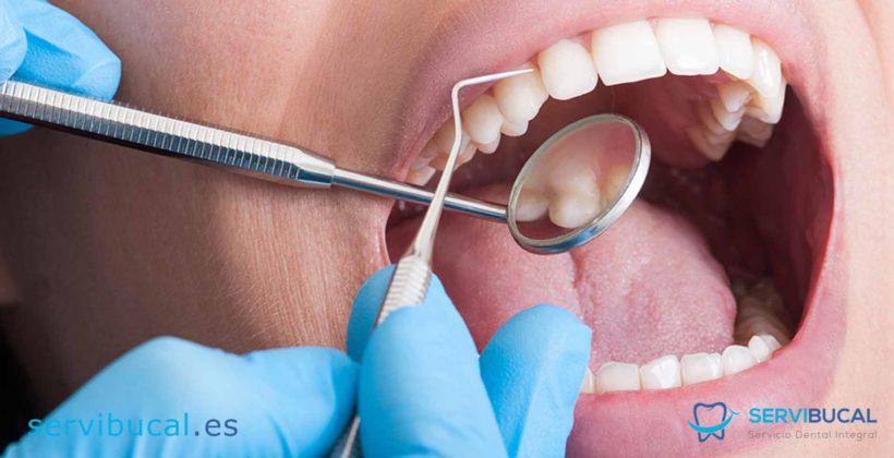 Definición de periodoncia, ¿qué es y en qué consiste? Definición de periodoncia, ¿qué es y en qué consiste?