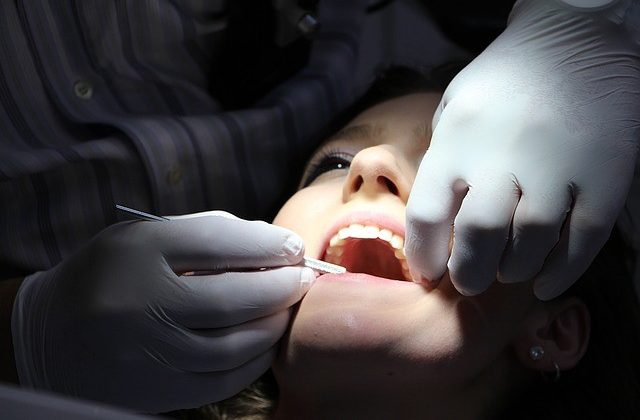 Placa dental, causas y cómo eliminarla Placa dental, causas y cómo eliminarla