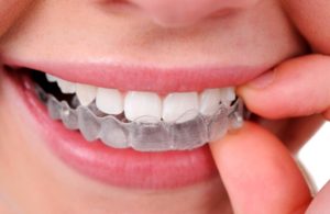 tipos de tratamientos dentales