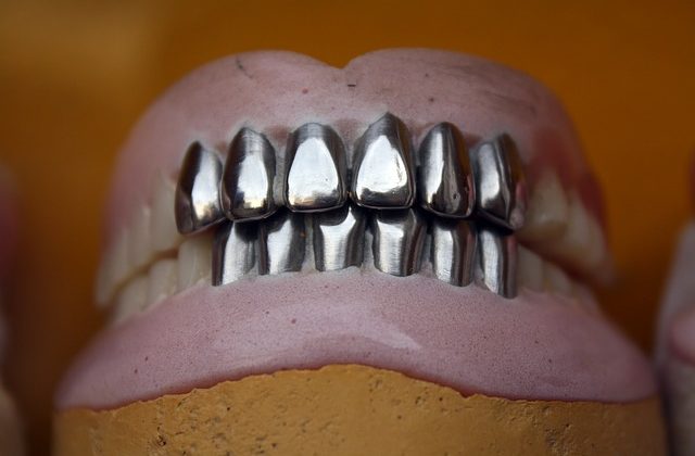 dentadura postiza fija