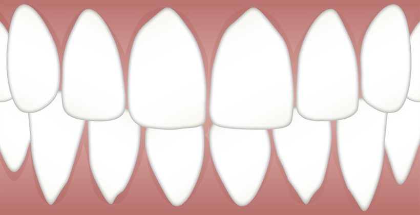 dientes incisivos