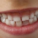 El nombre de los dientes y sus funciones