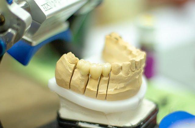 Reconstrucción dental. Tipos y cuidados