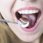 Todo lo que debes saber sobre la ortodoncia lingual