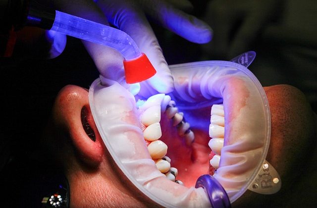¿Qué es el desbridamiento dental?