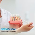 Implantes dentales baratos: Todo lo que debes saber sobre ellos