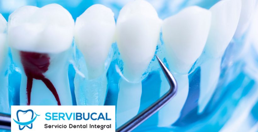 Precio de endodoncia: infórmate sobre todo lo que tienes que saber Precio de endodoncia: infórmate sobre todo lo que tienes que saber
