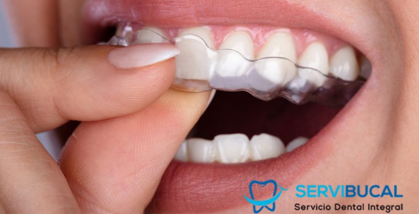 Bruxismo: tratamiento y causas del rechinar de dientes Bruxismo: tratamiento y causas del rechinar de dientes