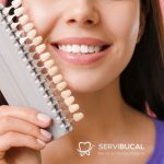 Precio de las carillas dentales y qué tipos existen