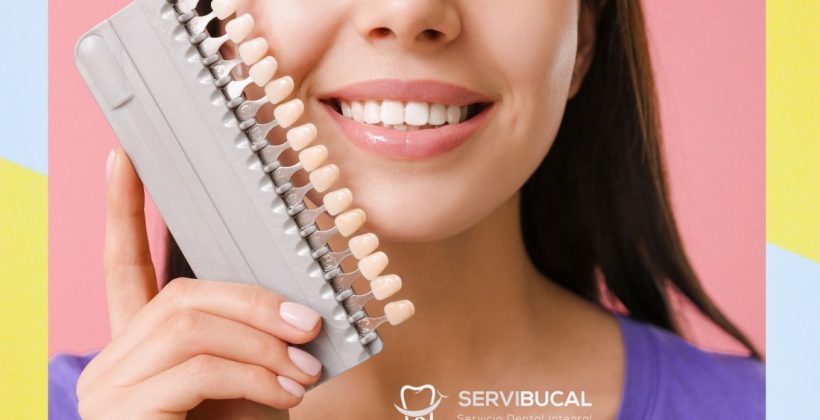 Precio de las carillas dentales y qué tipos existen Precio de las carillas dentales y qué tipos existen