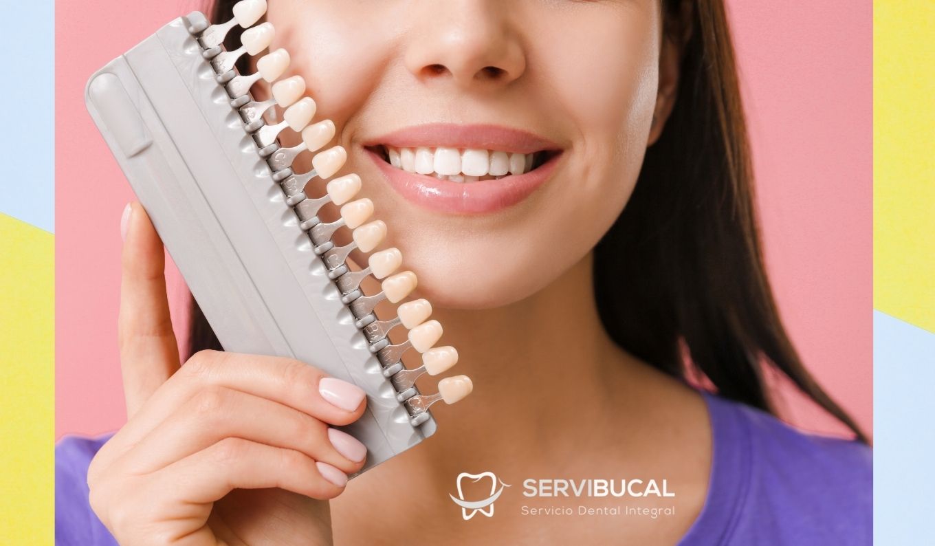 Cuál es el precio de las carillas dentales y qué tipos existen