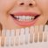 10 motivos por los que se manchan tus dientes