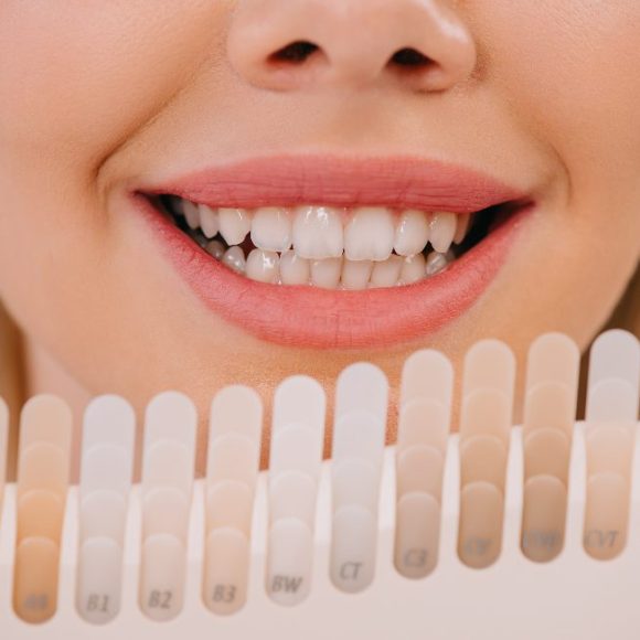 10 motivos por los que se manchan tus dientes