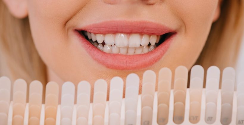 10 motivos por los que se manchan tus dientes 10 motivos por los que se manchan tus dientes