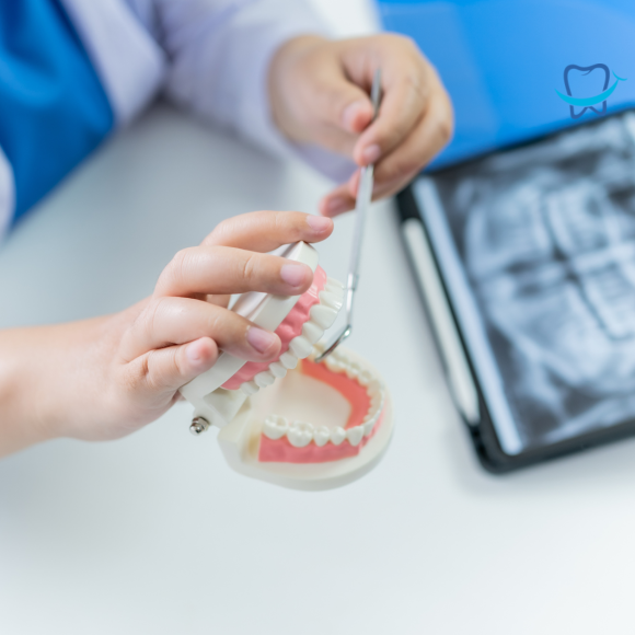¿Cómo saber si hay infección en un implante dental? Síntomas y signos de alarma