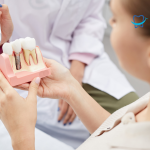 ¿Cómo saber si hay infección en un implante dental? Síntomas y signos de alarma
