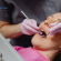 Mantenimiento periodontal: ¿qué es y cuándo se realiza?